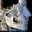 Scanatomy
