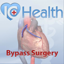 ArchieMD IC Health Coronary Bypass 1.2
