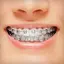 Braces 2.0.8