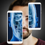 X ray Body Scanner Xray camera 1.3