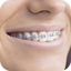 Teeth Braces Photo editor 1.7